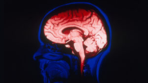 Researchers have long used imaging technology to try to understand mental-health ailments. But with relatively few participants, such studies may not be producing valid findings.