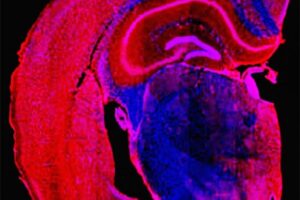 Scientists from the National Institutes of Health used a designer compound to prevent and reverse dementia-like brain damage caused by toxic tau protein in mice. Photo courtesy of Miller lab, Washington University,