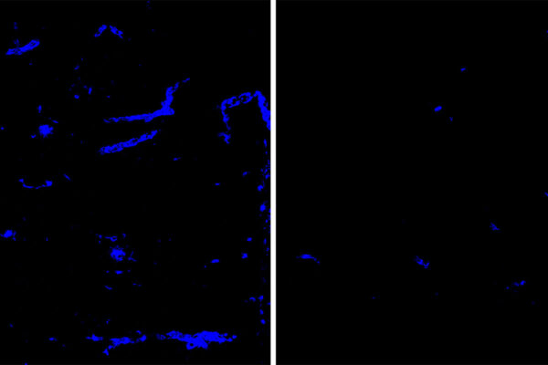 Protein linked to Alzheimer’s, strokes cleared from brain blood vessels