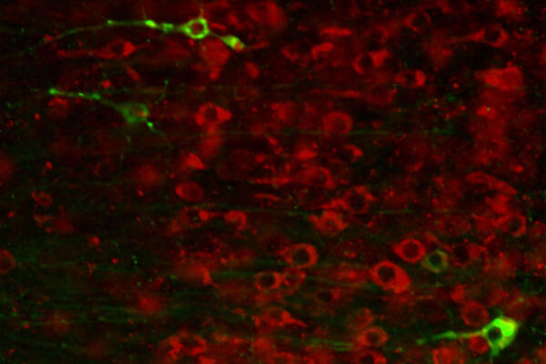 Drug compound halts Alzheimer’s-related damage in mice