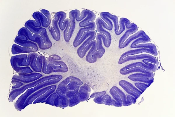 The Underestimated Cerebellum Gains New Respect From Brain Scientists