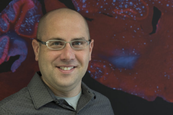 Cirrito receives MetLife award for Alzheimer’s research