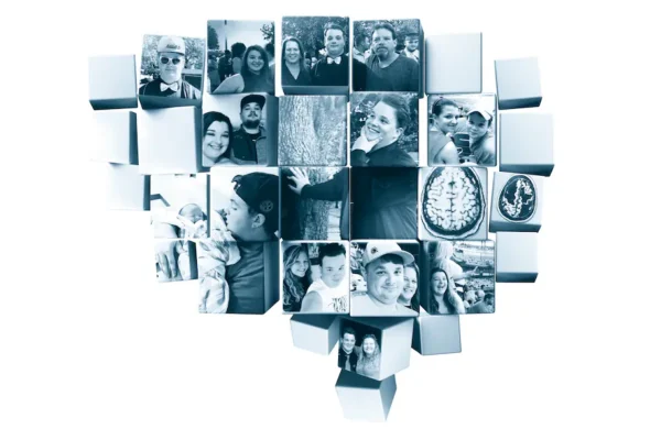 A newborn lost large parts of his brain. Today, he’s an athletic college grad.￼