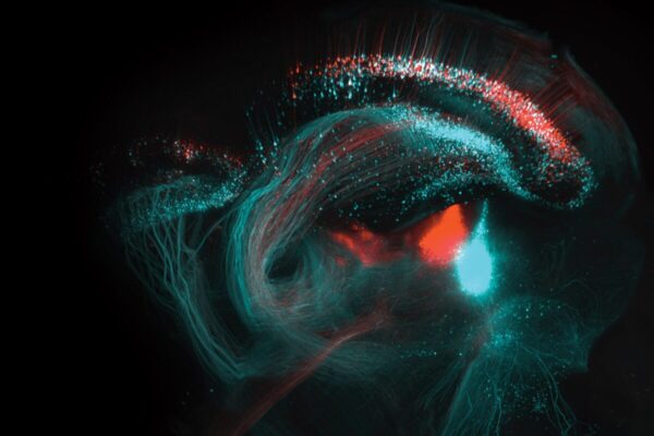 University launches new era of progress in neuroscience