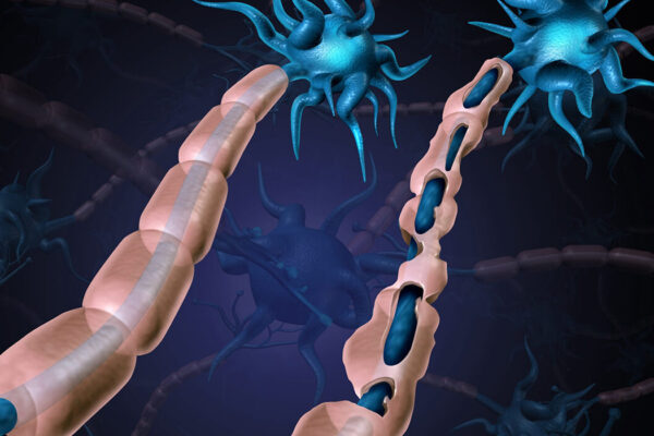 Healthy brains suppress inappropriate immune responses