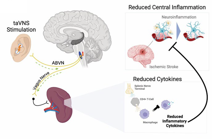 A diagram of a brain undergoing vagus nerve stimulation, showing reduced inflammation and reduced cytokines