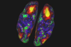 A research team led by scientists at Washington University in St. Louis will scan the brains of kindergartners to centenarians to capture the changes that occur as brains develop, mature and age over the lifespan. The above image shows a compilation of healthy adult brains at rest, to illustrate the brain's functional connections as captured by MRI.