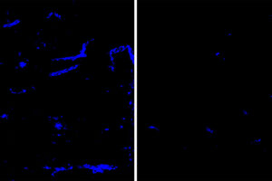 Amyloid deposits (blue) in mouse brain tissue and blood vessels are reduced after treatment with an antibody that targets the protein APOE (right), a minor component of amyloid deposits, compared to a placebo antibody (left). Amyloid deposits in the brain increase the risk of dementia and strokes. Researchers at Washington University School of Medicine in St. Louis have identified an antibody that clears amyloid deposits from the brain without raising the risk of brain bleeds.