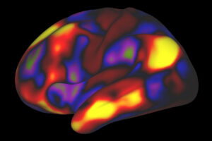 A functional MRI scan reveals the default mode network in the brain of a person at rest (above). Researchers with the Adult Aging Brain Connectome Study are collecting these and similar brain scans from 1,000 adults to study risk and resilience in the aging brain. The project, which involves researchers at Washington University School of Medicine in St. Louis and other institutions, is funded by a $33.1 million grant from the National Institute on Aging.