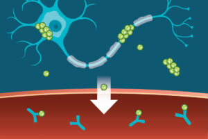 Caption: The protein tau (green) aggregates abnormally in a brain cell (blue). Tau spills out of the cell and enters the bloodstream (red). Research shows that antibodies (blue) can capture tau in the blood that reflect its levels in the brain. Credit: Sara Moser