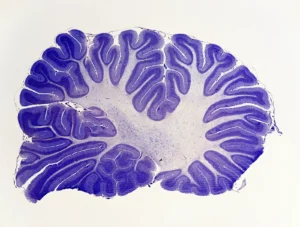 The cerebellum, a brain structure humans share with fish and lizards, appears to control the quality of many functions in the brain, according to a team of researchers.