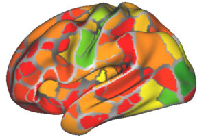 Brain networks from nine people were analyzed to generate the heat map above, which shows the areas that change the most (red) to the least (green), from person to person. A new study shows that individual brain networks are remarkably stable from day to day and while undertaking different tasks, suggesting that finding differences between individuals could help diagnose brain disorders or diseases.