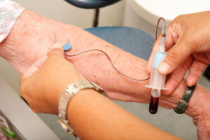 Alzheimer’s blood test performs as well as FDA-approved spinal fluid tests